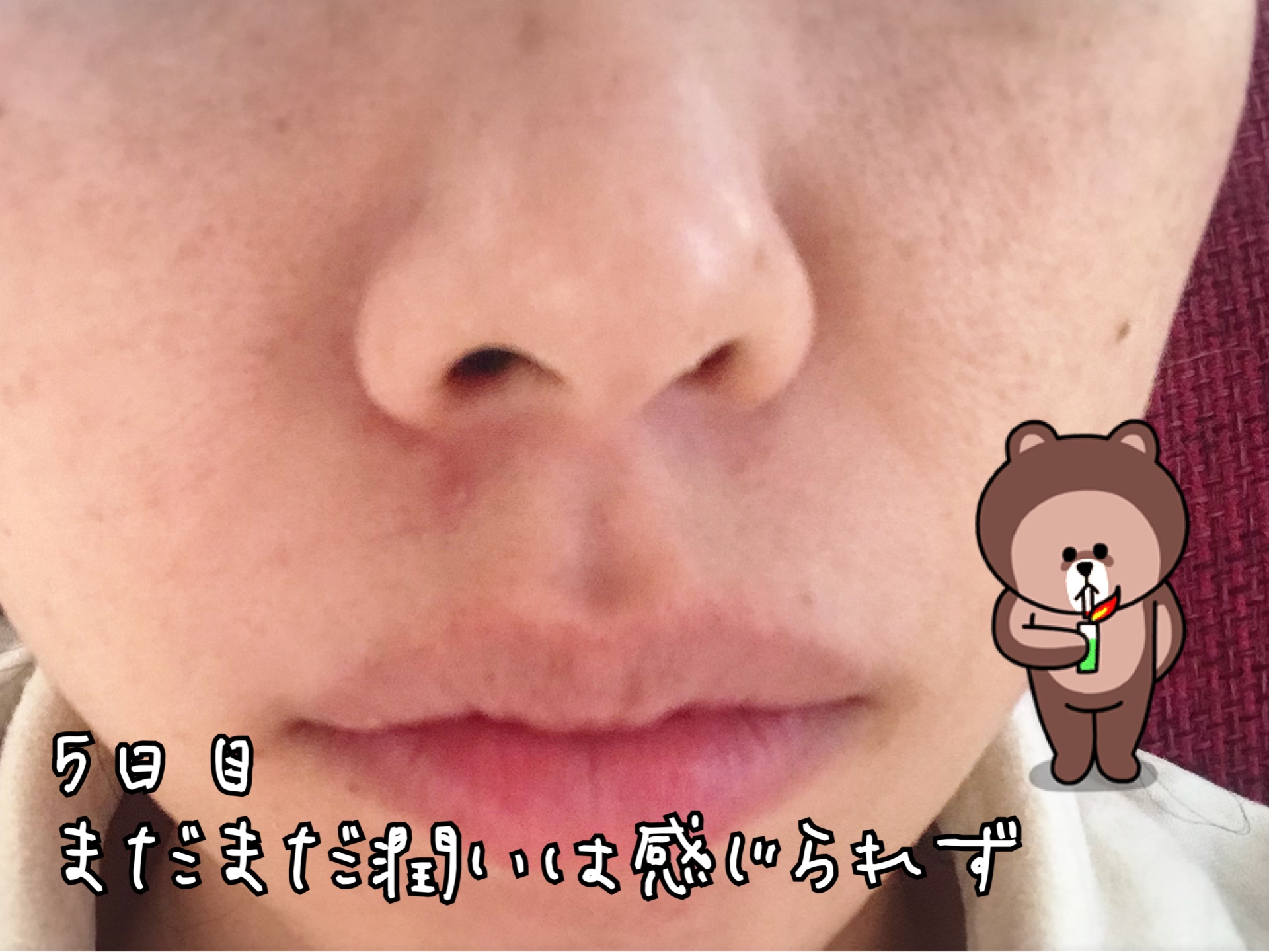 天使のララ コラーゲンサプリ