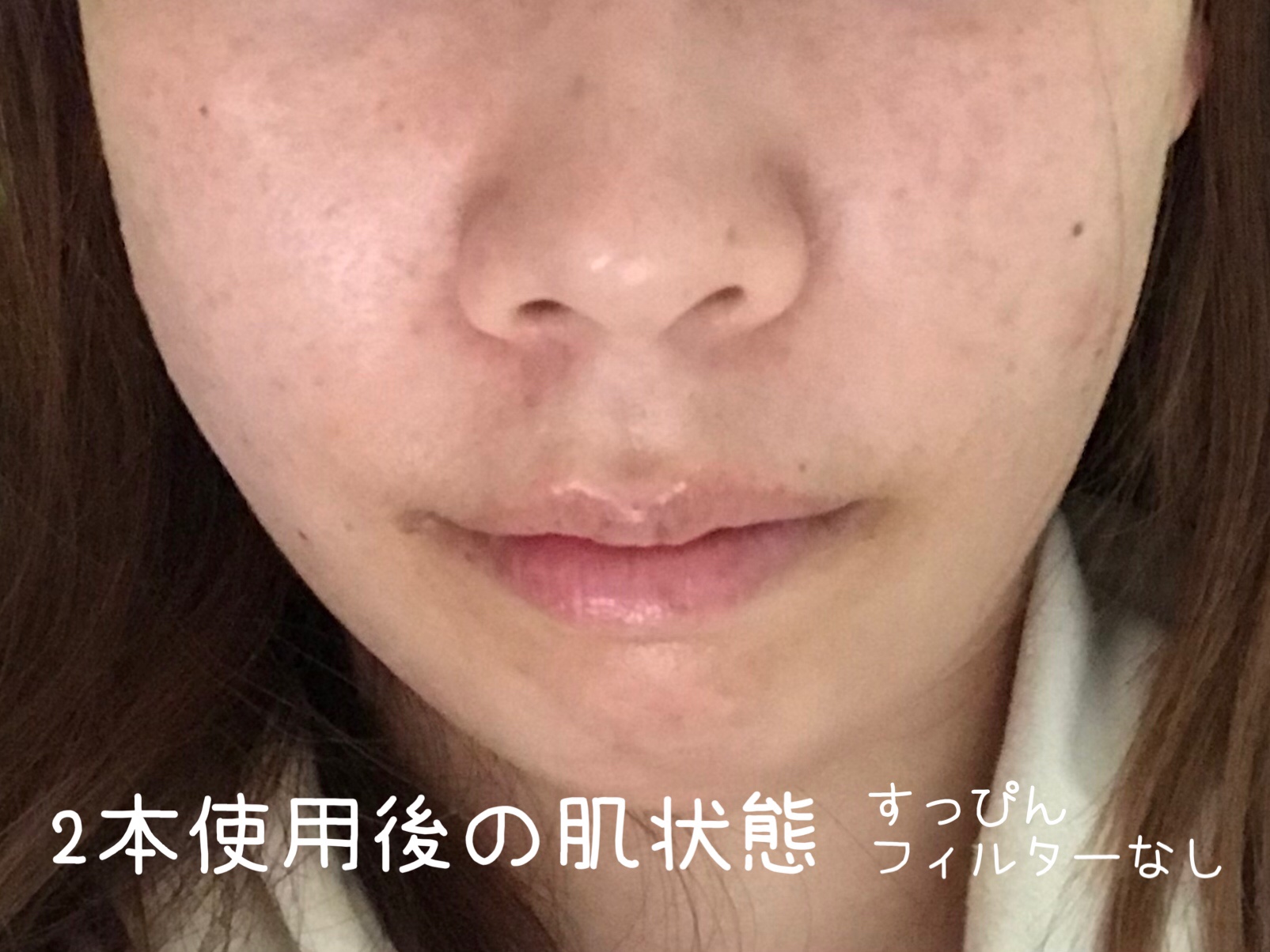 肌タイプ診断