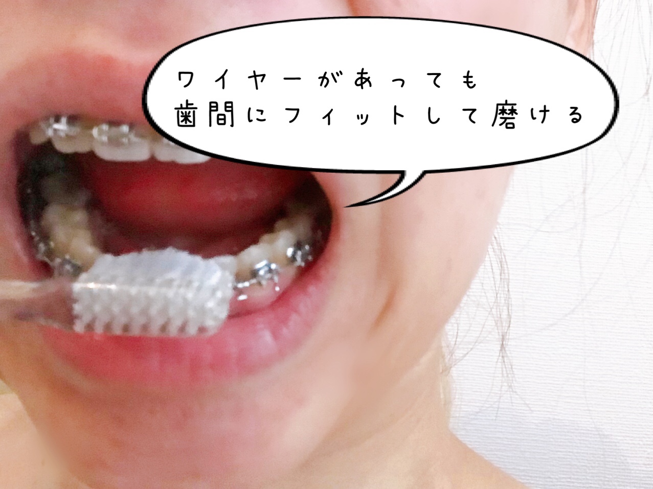 奇跡の歯ブラシ